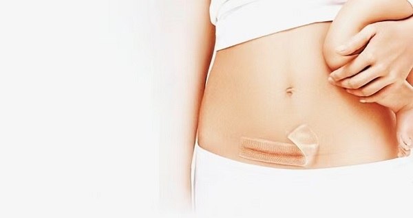 Mengapa Lembaran Bekas Luka Gel Silikon Tebal Begitu Populer?