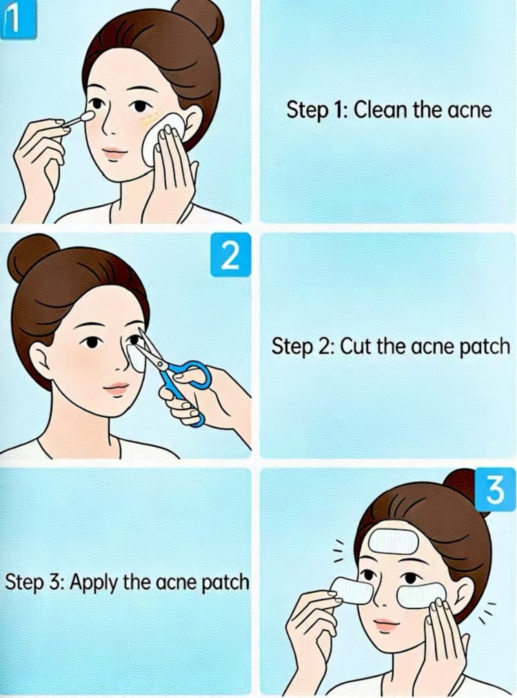Cara Pemakaian Cmallbio Acne Patch dan Perawatan Jerawat Sehari-hari