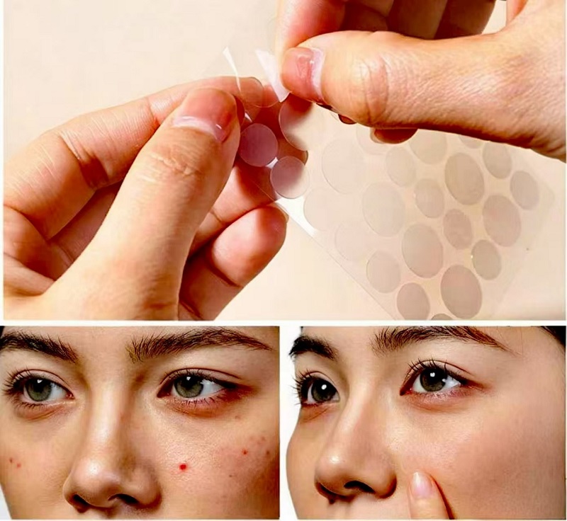 Cara Menggunakan CmallBio Pimple Patch Semalaman untuk Hasil Maksimal？